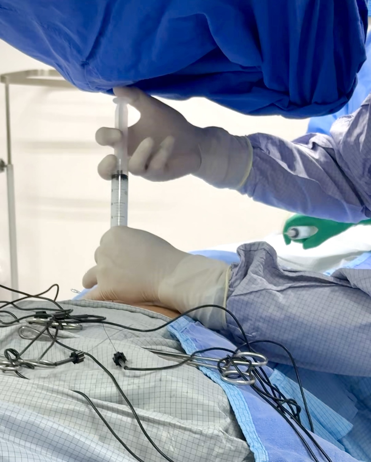 deposito de esteroide